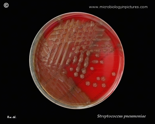 streptococcus pneumoniae, pneumococcus, pure culture